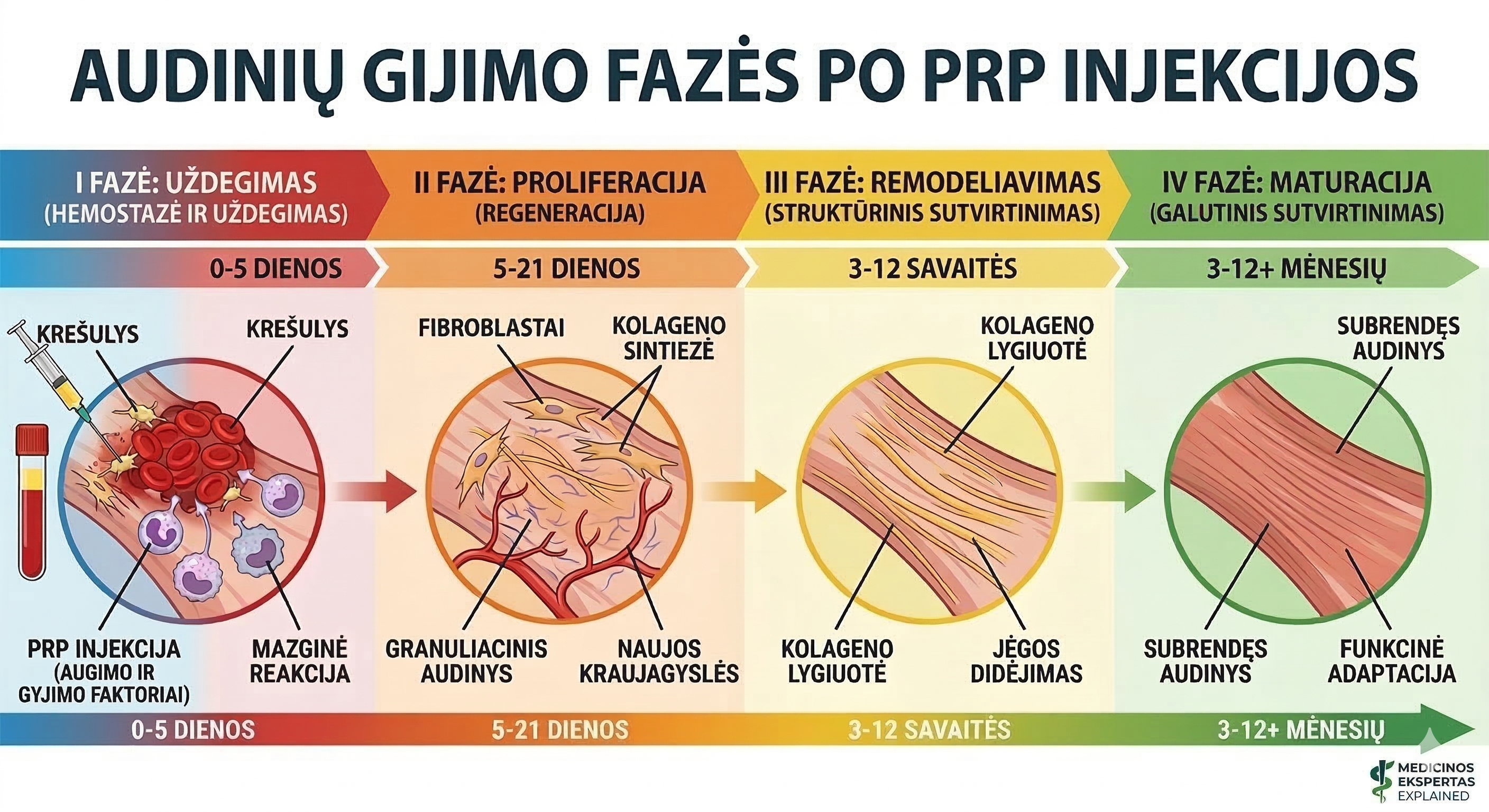 Audinių gijimo fazės po PRP injekcijos: uždegimas, proliferacija, remodeliavimas ir maturacija